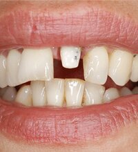 Dental-front-2.png