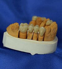 Dental---011-010.png
